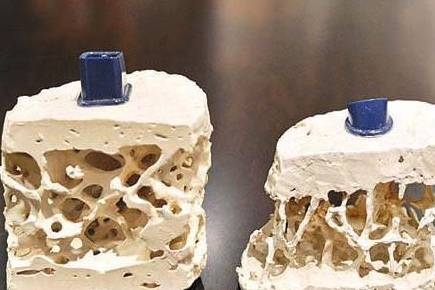 Canh xương hầm có thật sự chứa nhiều canxi như bạn nghĩ?