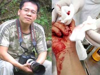 Bảo vệ nhà báo thế nào đây?