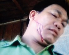 truy bat doi tuong danh kiem lam trong thuong