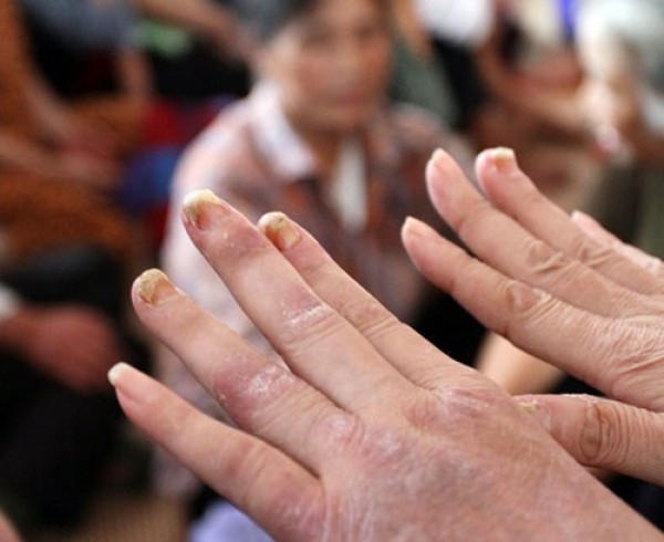 Cận cảnh "mát-xa chữa bách bệnh" của "cô" Phú Thái Nguyên can canh mat xa chua bach benh cua co phu thai nguyen