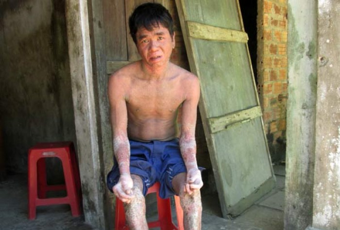 trai long cua cha con nguoi ran