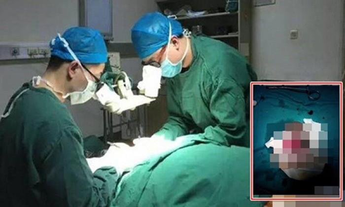 Tự xẻo ‘của quý’ vì bị chê ‘bất tài’ đẻ toàn con gái