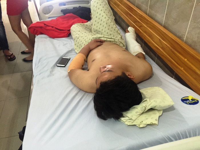 mot thanh nien bi con do chem guc trong quan ca phe