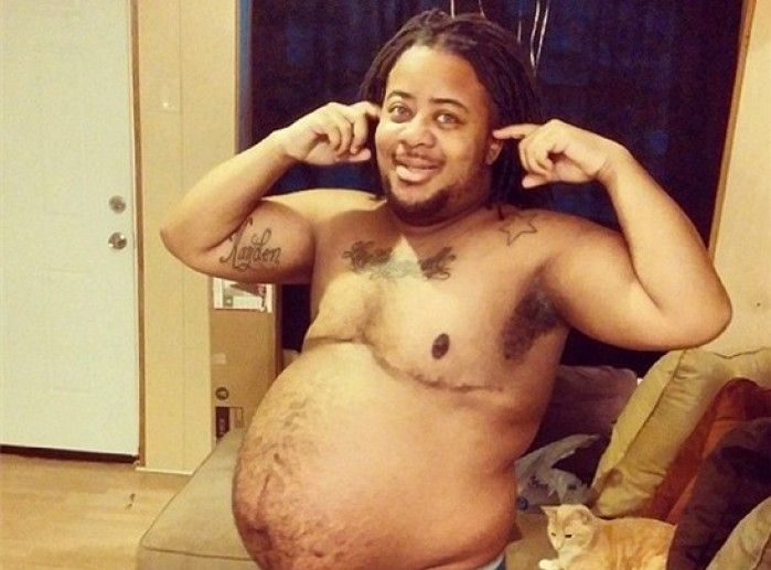 Người đàn ông mang thai sau nhiều năm chuyển giới