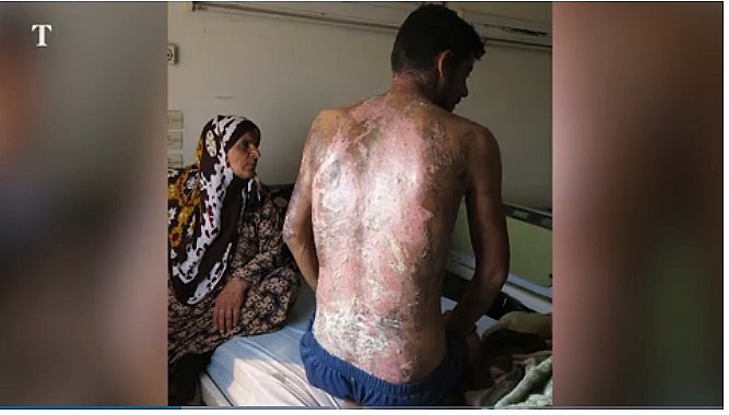 tho nhi ky su dung vu khi hoa hoc chong lai nguoi kurd o syria