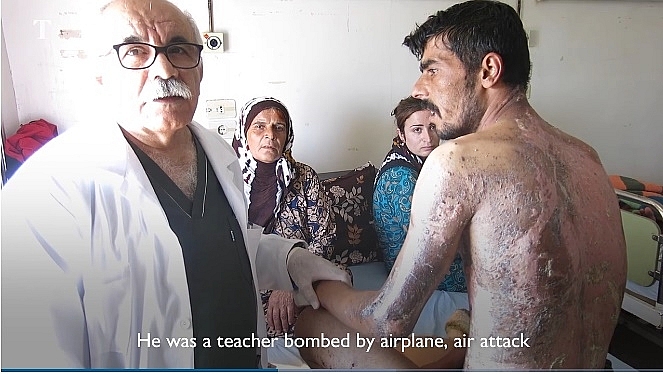 tho nhi ky su dung vu khi hoa hoc chong lai nguoi kurd o syria