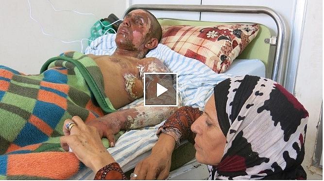 tho nhi ky su dung vu khi hoa hoc chong lai nguoi kurd o syria