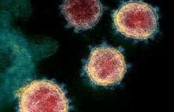 Chuyên gia Nga đề xuất cách tiêu diệt virus corona nhanh gọn lẹ