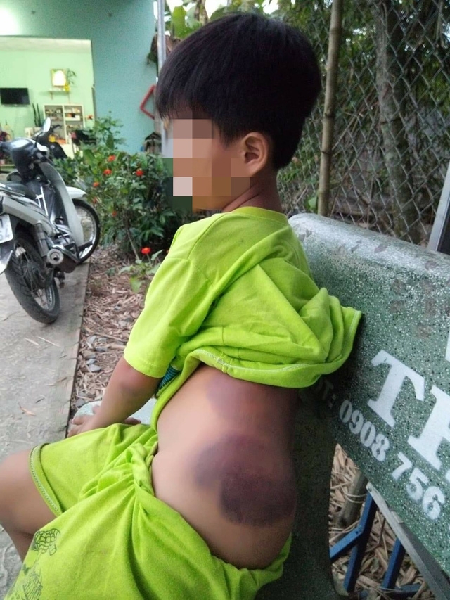 tin tuc trong nuoc hom nay 812