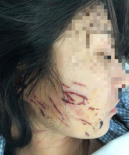ba phu nu bi khoi to vi danh ghen lot do chu tiem spa