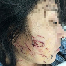 bat gian tai tran hoan thu dap lien tiep vao mat bo nhi tut quan gian phu doi xeo