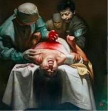 y vien quan doi trung quoc cau ket voi y vien tu nhan buon ban noi tang nguoi