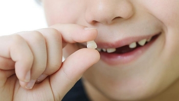 Lưu răng sữa trị nhiều bệnh về sau?