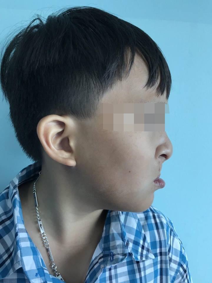 hanh trinh 10 nam tim lai nu cuoi cua em be bi di tat xuong ham bam sinh