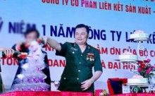 bo sau lien ket viet sap dung truoc vanh mong ngua