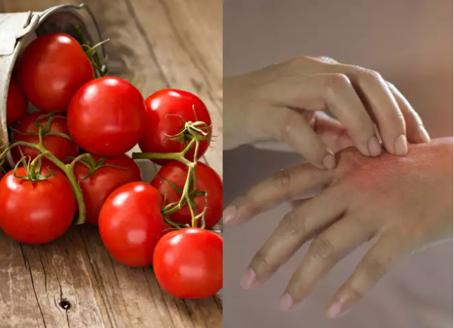 Những ai không nên ăn cà chua?