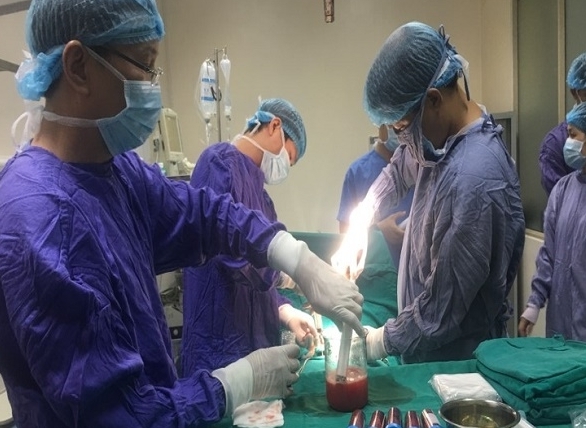 Phương pháp mới điều trị đột quỵ não từ tế bào gốc tự thân