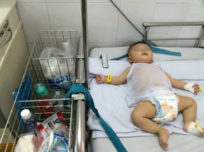 be trai bi dam xuyen so nhap vien vi viem mang nao
