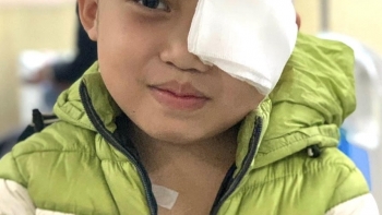 Bệnh viện K phẫu thuật thành công u máu khủng cho cậu bé 8 tuổi người dân tộc Dao