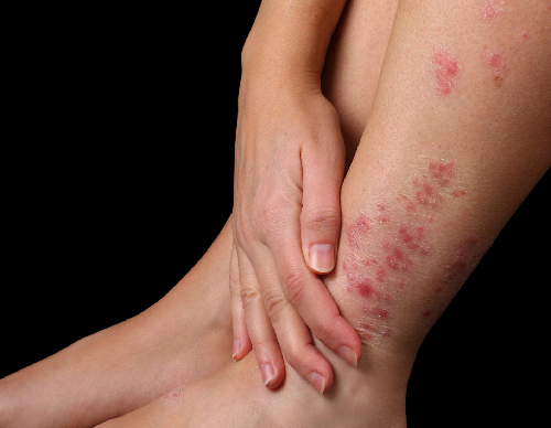 Thuốc lá hủy hoại nhan sắc của bạn như nào?