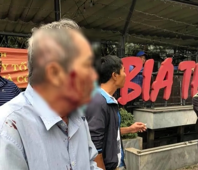 ha noi dieu tra vu cu ong 80 tuoi bi danh nhap vien