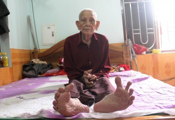Cụ ông bách niên có bàn chân Giao Chỉ