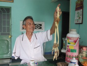 Người thương binh sau nửa thế kỉ bỗng gặp lại cánh tay mình