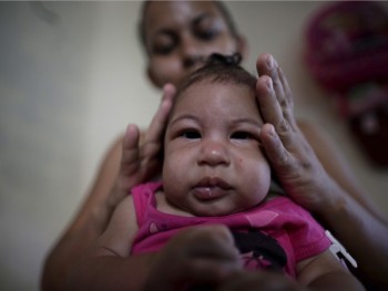 Virus Zika nguy hiểm như thế nào?