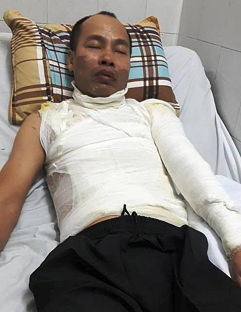 Bé gái 9 tuổi hoảng loạn chứng kiến bố bị tạt axit ngay trước mặt