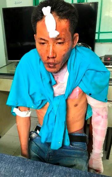 hai chau be bi cha duong dung xang dot da tu vong