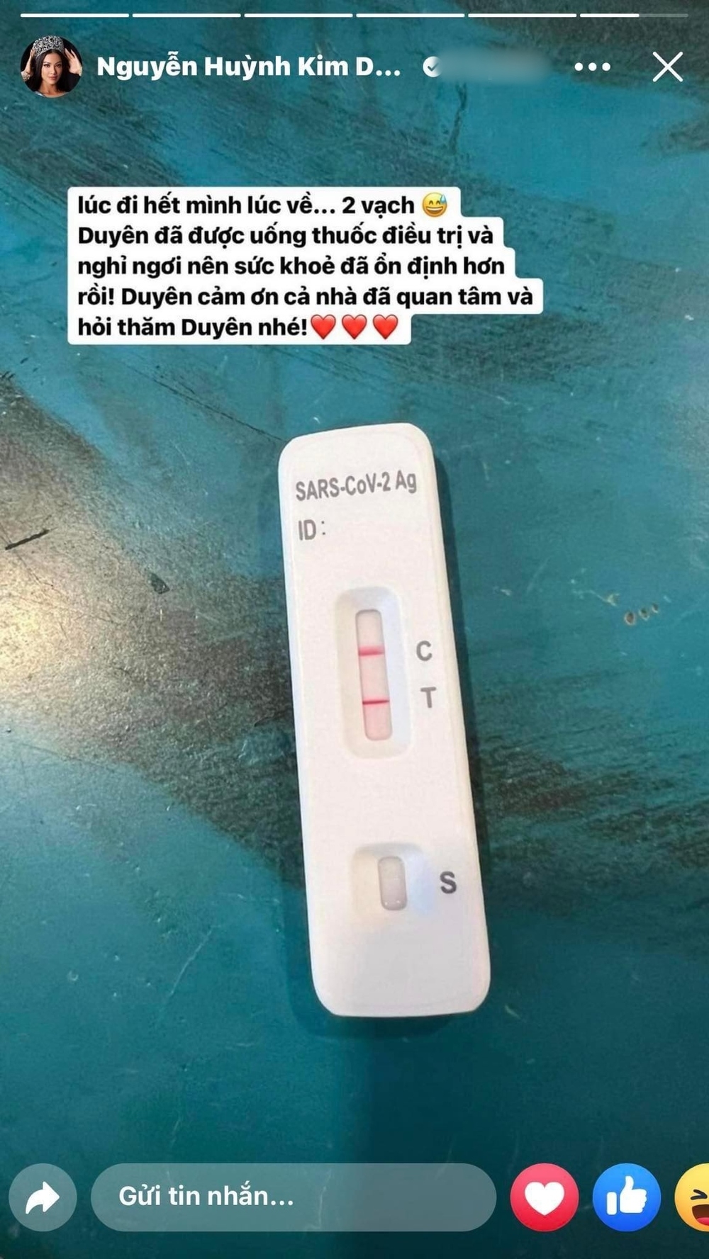 Á hậu Kim Duyên dương tính với Covid-19