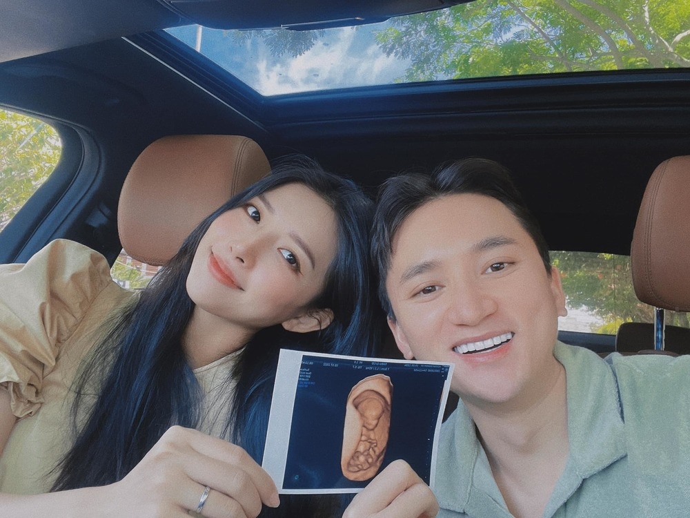 Sao Việt hôm nay 21/7: Huyền Lizzie chia sẻ về sự cố khi ghi hình 