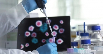 Tìm thấy điểm yếu "chí tử" của virus SARS-CoV-2