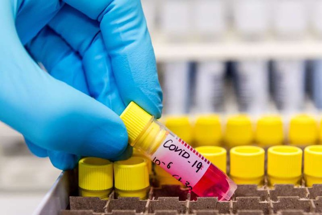 Malaysia phát hiện chủng virus gây bệnh Covid-19 lây nhiễm gấp 10 lần
