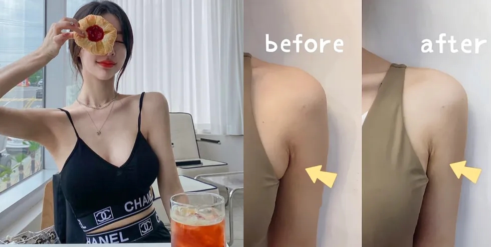 Bài tập đơn giản loại bỏ mỡ nách tích tụ 10 phút mỗi ngày