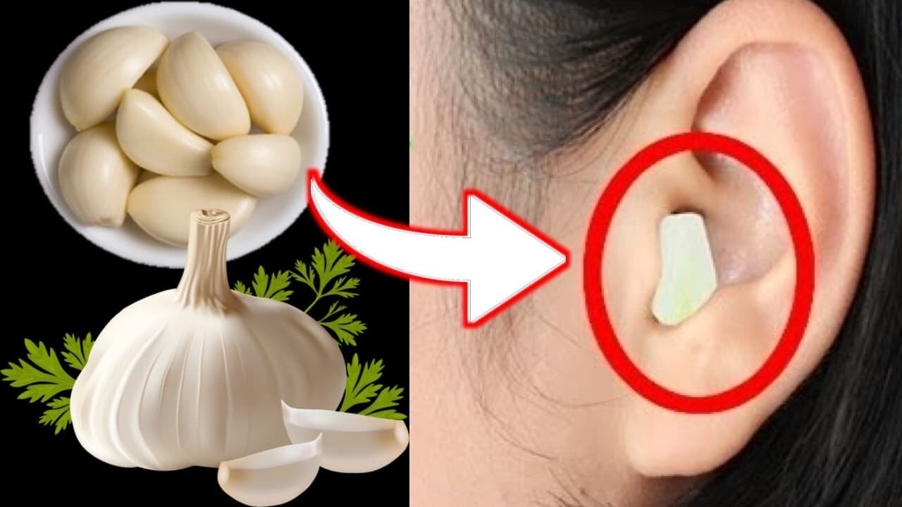 Chuyện gì sẽ xảy ra nếu bạn nhét tỏi vào tai?