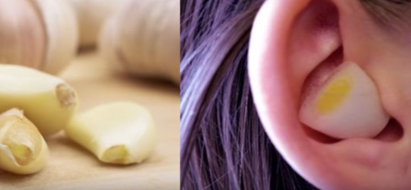 Chuyện gì sẽ xảy ra nếu bạn nhét tỏi vào tai?