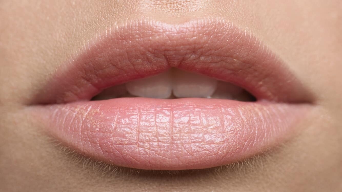 Nhìn tình trạng đôi môi để biết được sức khỏe bản thân