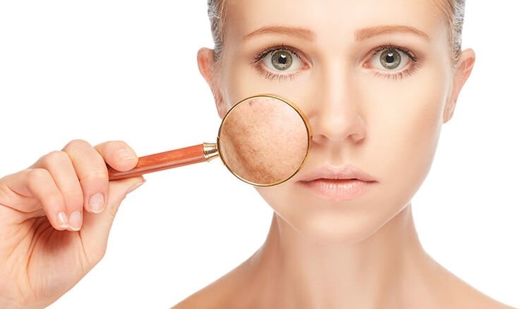 Truy tìm kẻ thù của sức khỏe làn da