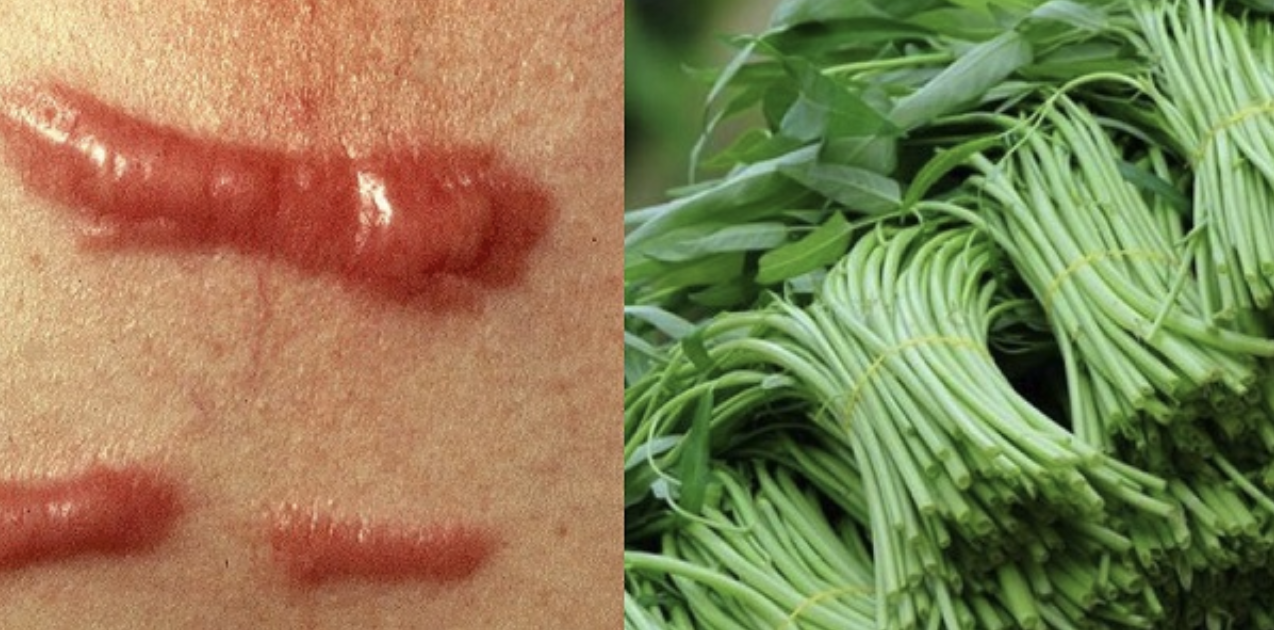 5 cách ăn rau muống sai lầm, dễ rước bệnh vào thân