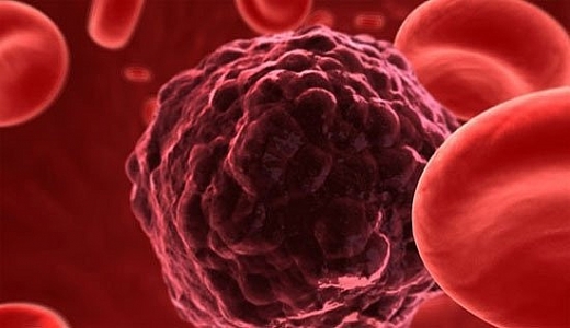 Phương pháp mới buộc tế bào ung thư tự phá hủy phuong phap moi buoc te bao ung thu tu pha huy