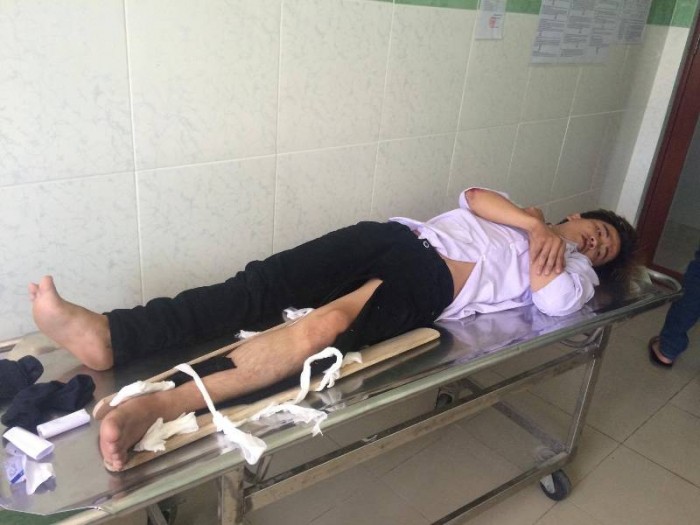 hai thanh nien di xe may tong gay chan csgt