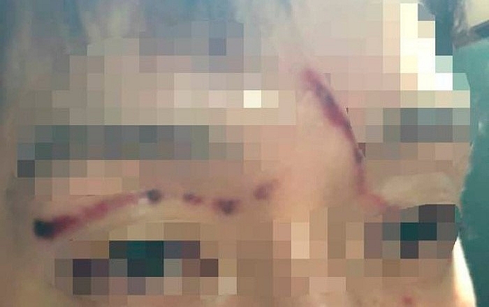 bup be xu han goo hara tung bang chung bi ban trai hanh hung