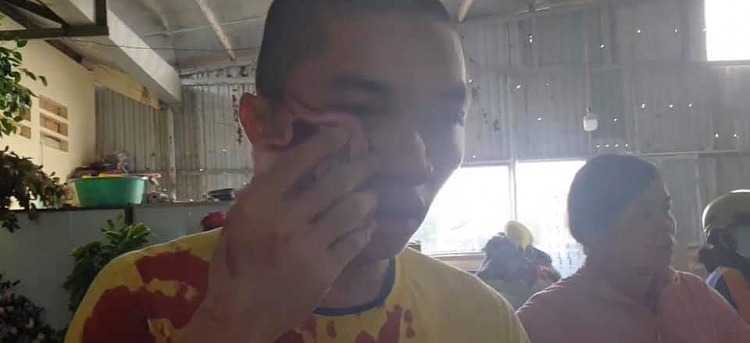 vu dai nao tinh that bong lai tinh that mat cap 300 trieu dong