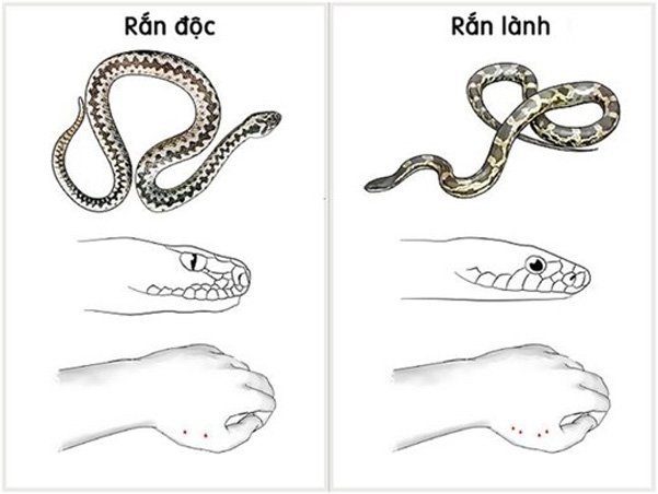 Cách sơ cứu nhanh khi bị rắn cắn