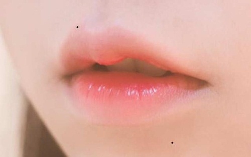 3 nốt ruồi này trên cơ thể, bạn sẽ giàu sang, an nhàn sung túc