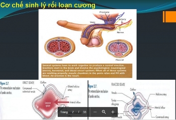 SOS: Nam giới mắc rối loạn cương dương gia tăng