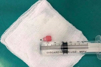 Bé gái 6 tuổi ngưng tim vì hóc đầu bút chì