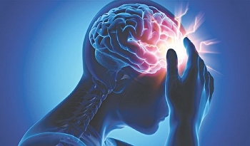 Hơn 230.000 người Việt bị đột quỵ mỗi năm