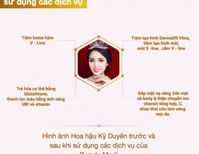 my nhan viet ai dam nhan nguoi dep dao keo 415611